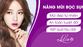 Nâng mũi bọc sụn