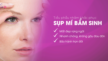 Sụp mí bẩm sinh