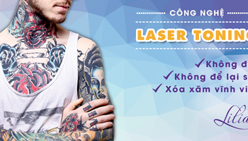 Xóa xăm công nghệ Toning Laser