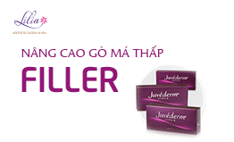 Nâng cao gò má thấp bằng Filler