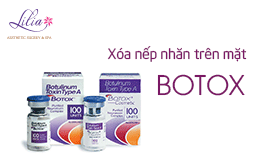 Xóa nếp nhăn trên mặt bằng Botox
