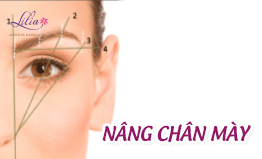Nâng chân mày