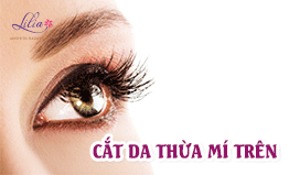 Cắt da thừa mí mắt trên