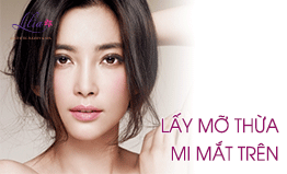 Lấy mỡ mí mắt trên