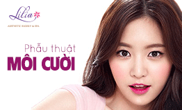 Phẫu thuật môi cười