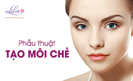 Tạo môi chẻ