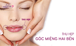 Thu hẹp góc miệng hai bên