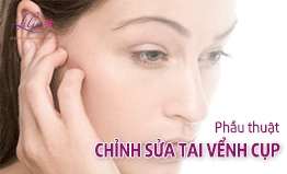 Chỉnh sửa tai vểnh cụp