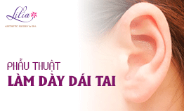 Làm dày dái tai