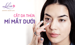 Cắt da thừa mí mắt dưới