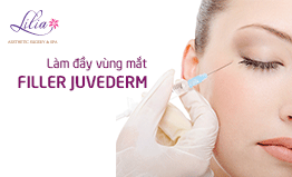 Làm đầy vùng mắt bằng Filler