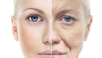 Ưu điểm vượt trội trẻ hoá da Smas RF Shapher so với công nghệ Thermage