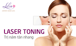 Trị nám, tàn nhang công nghệ Laser Toning