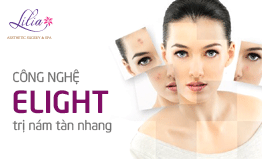 Trị nám, tàn nhang công nghệ E-light