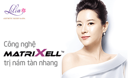 Trị nám, tàn nhang công nghệ Matrixell