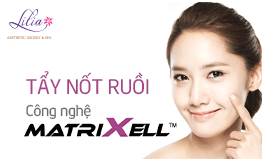 Tẩy nốt ruồi công nghệ Matrixell