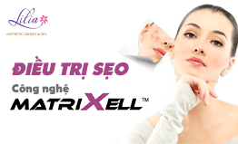 Điều trị sẹo công nghệ Matrixell
