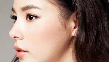 Nâng mũi bằng filler giá bao nhiêu?
