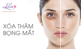 Xóa thâm, xóa bọng mắt với công nghệ Smas RF Shaper