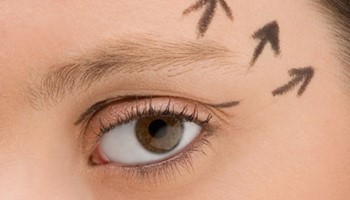 Cắt mí Hàn Quốc – Cách làm mắt to, đẹp hút hồn như sao Hàn
