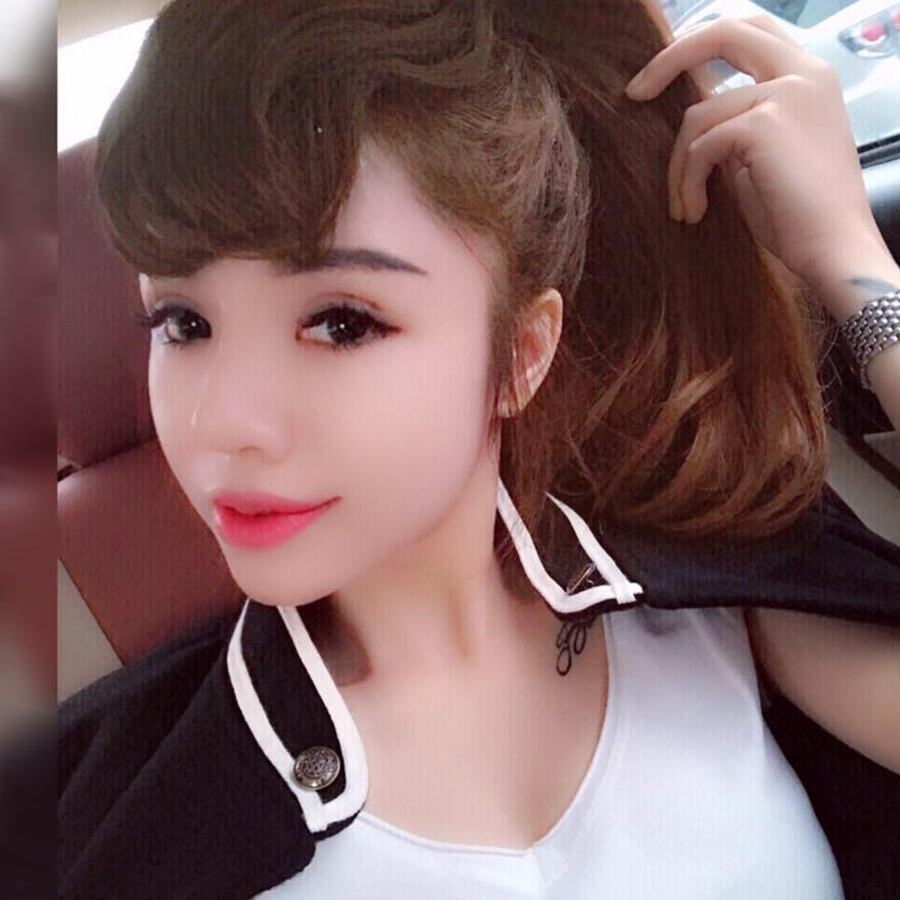 Hotgirl Ngọc Huyền – Sửa cằm cũ 