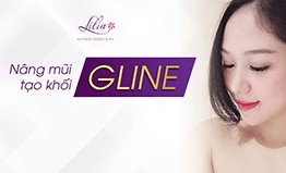 NÂNG MŨI TẠO KHỐI G LINE – TỶ LỆ VÀNG HÀI HÒA KHUÔN MẶT
