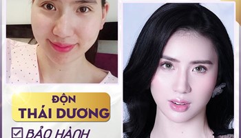 THẨM MỸ VIỆN LILIA- ĐỊA CHỈ ĐỘN THÁI DƯƠNG UY TÍN.