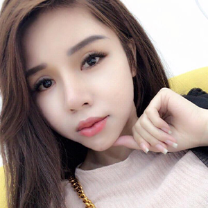 Độn cằm Vline