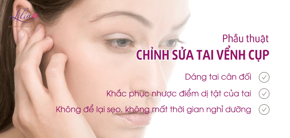 Phẫu thuật chỉnh sửa tai vểnh cụp