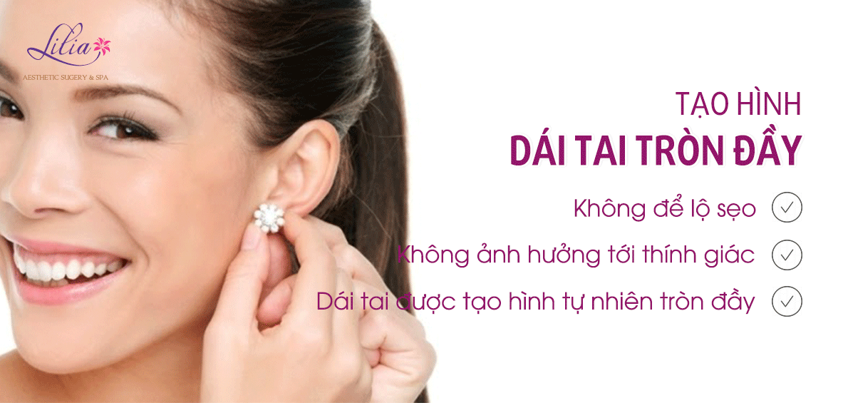 Phẫu thuật tạo hình dái tai tròn đầy