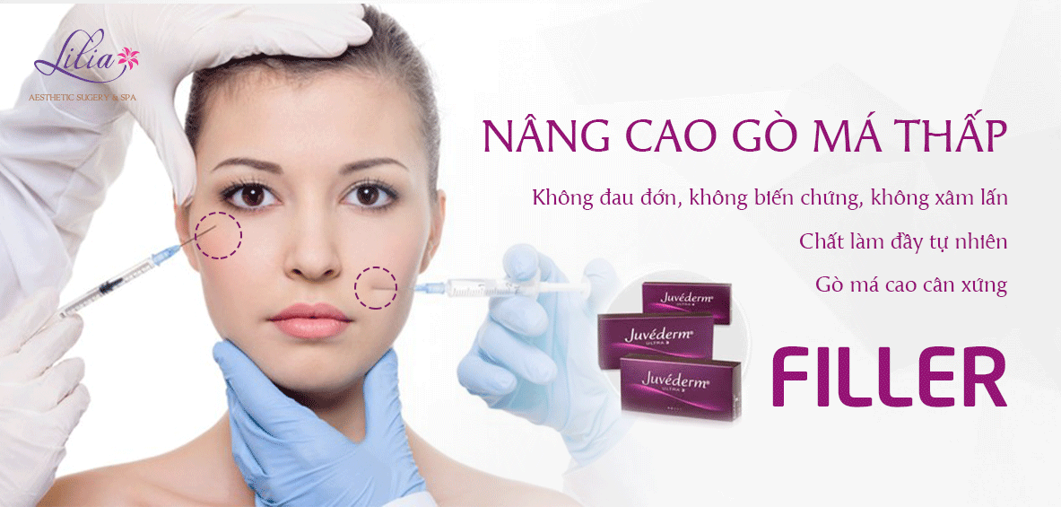 nâng cao gò má filler