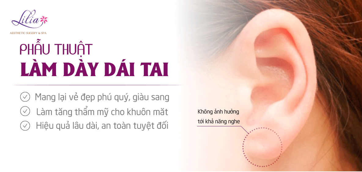 Làm dày dái tai