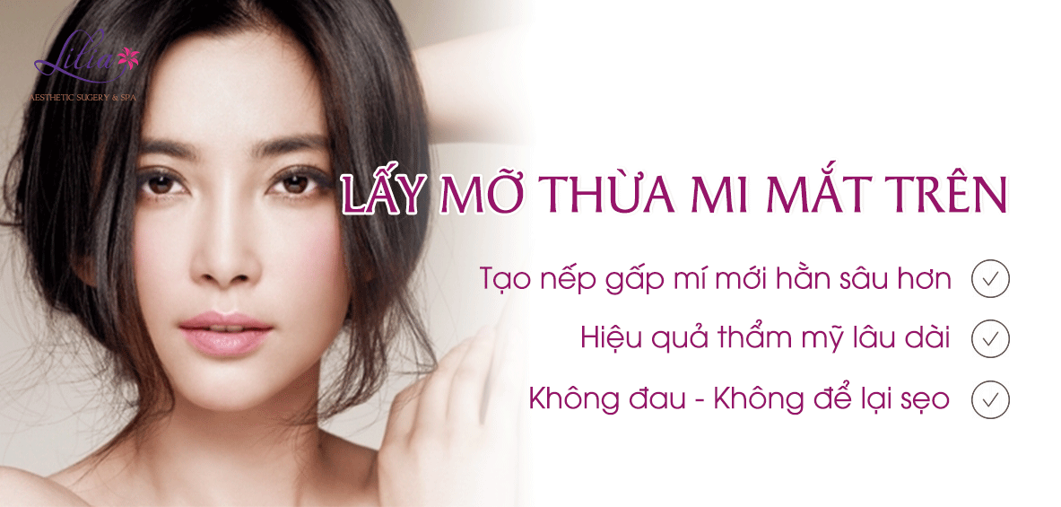 Lấy mỡ mí mắt trên