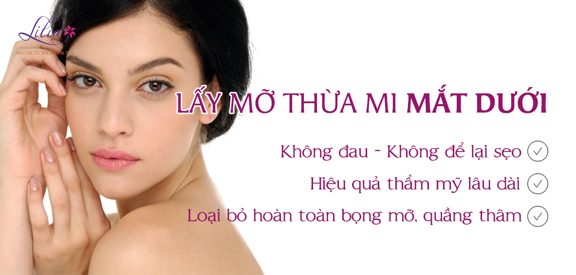 Lấy mờ thừa mí mắt dưới 
