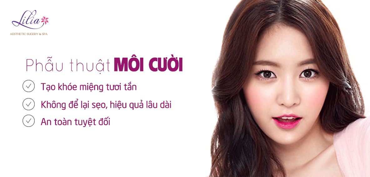 Phẫu thuật môi cười