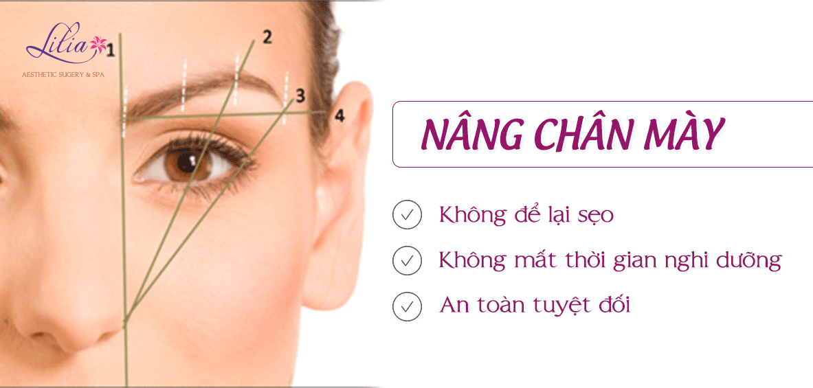 Nâng chân mày