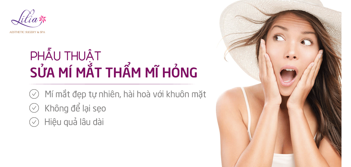 Sửa mí mắt thẩm mỹ hỏng