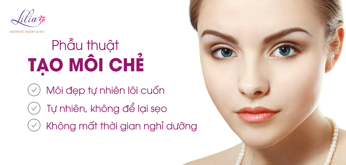 Tạo môi chẻ
