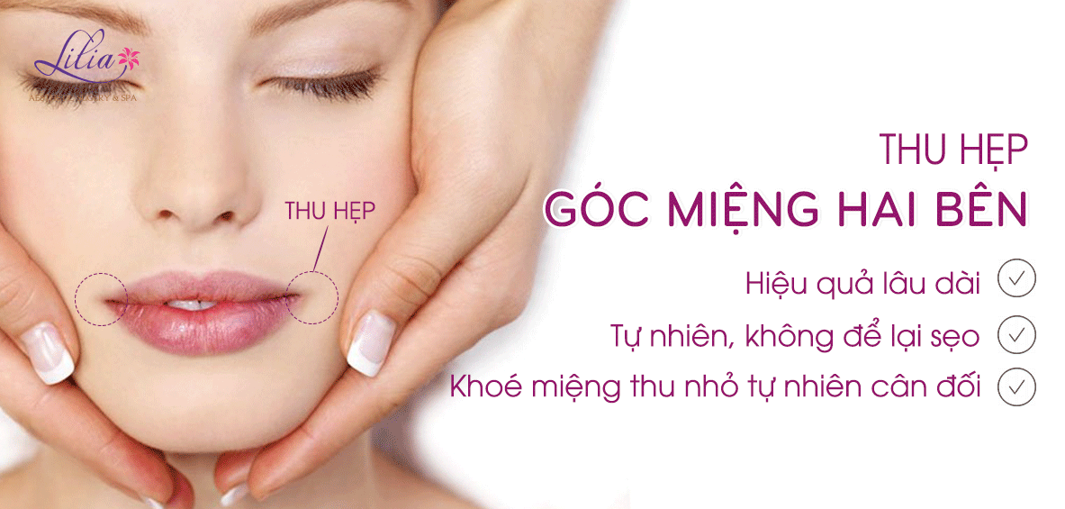 Thu hẹp góc miệng hai bên