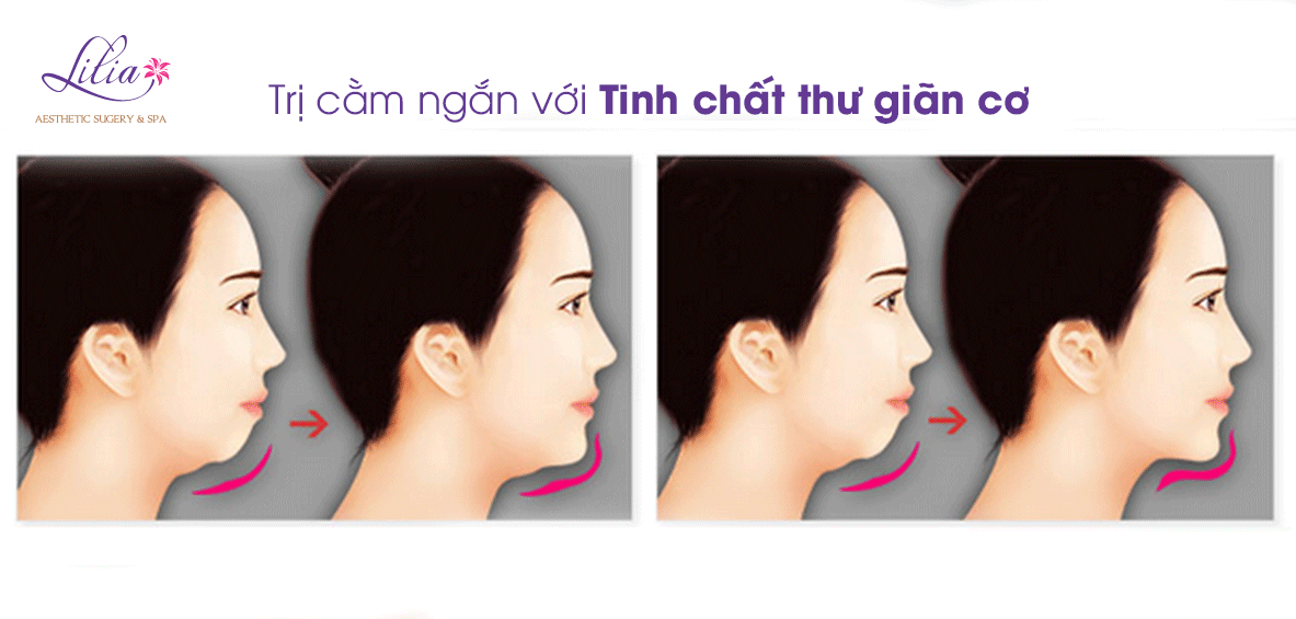 trị cầm ngắn