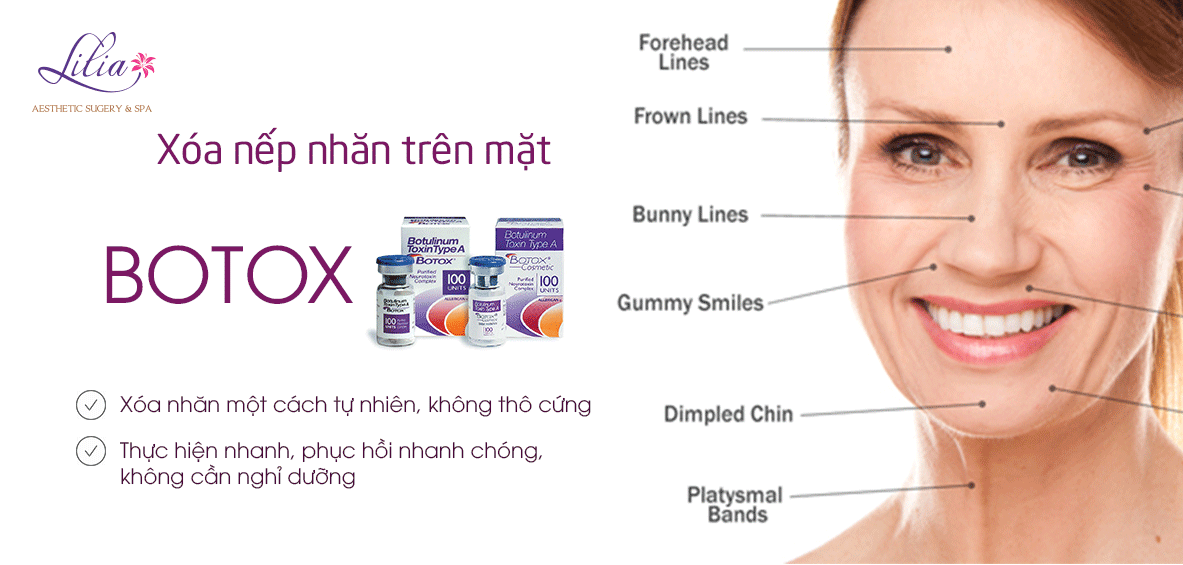 Xóa nếp nhăn trên mặt