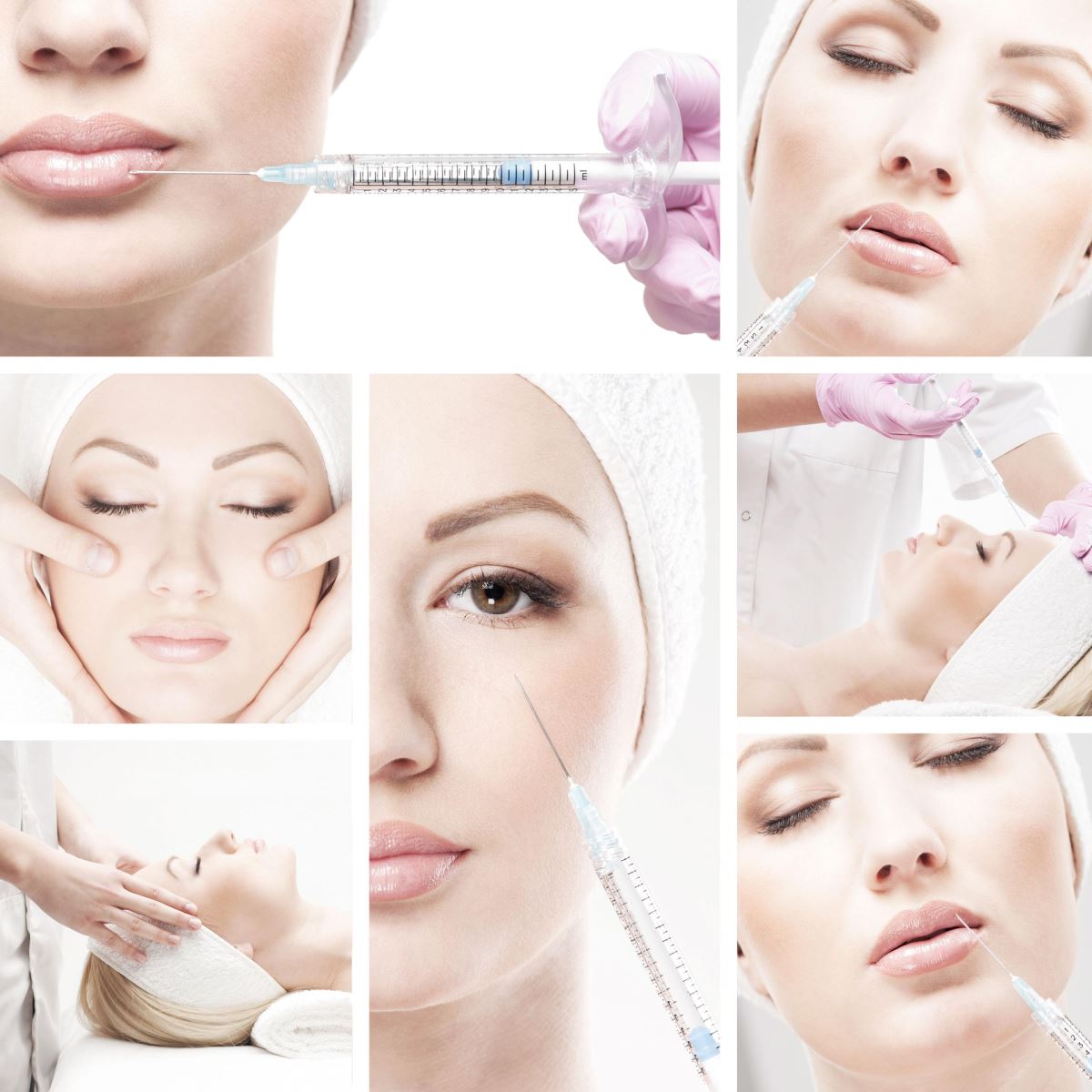 nâng mũi không phẫu thuật filler