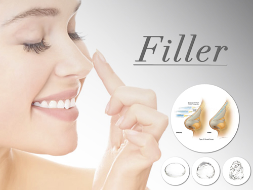 nâng mũi không phẫu thuật filler