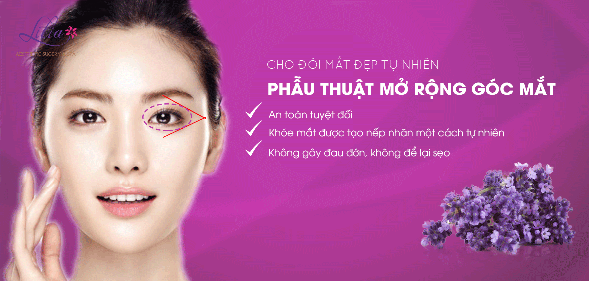 Mở rộng góc mắt