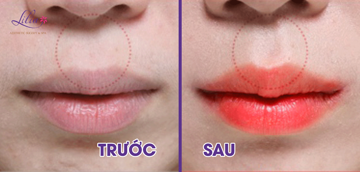 Tạo hình môi trái tim