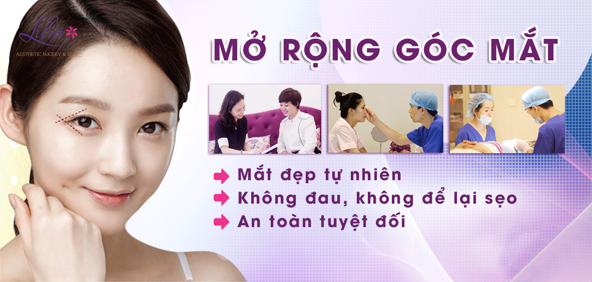 Mở rộng góc mắt
