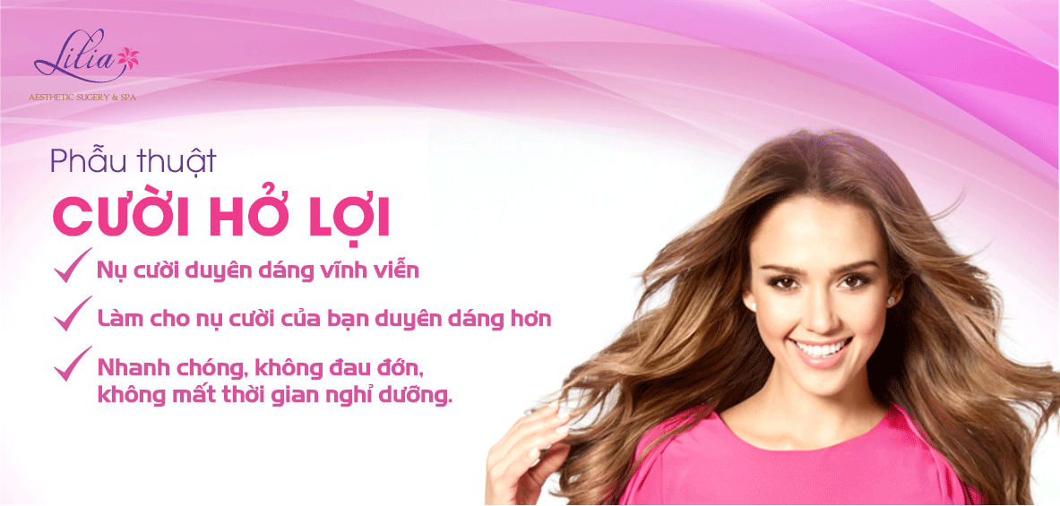 Phẫu thuật chữa cười hở lợi