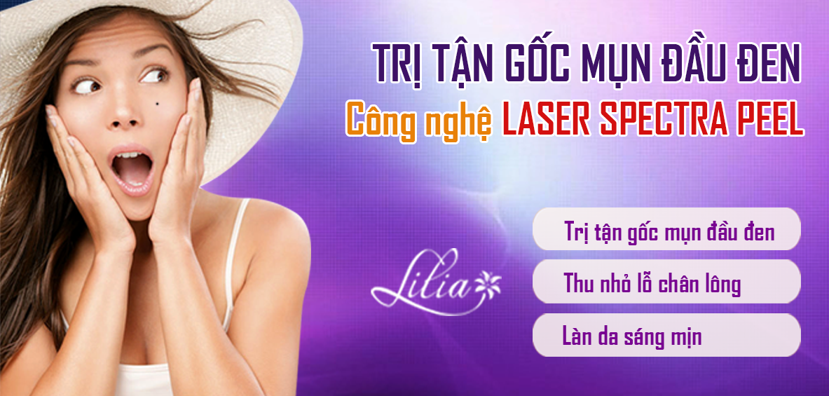 Trị mụn đầu đen