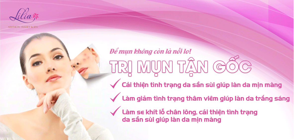 Trị mụn tận gốc