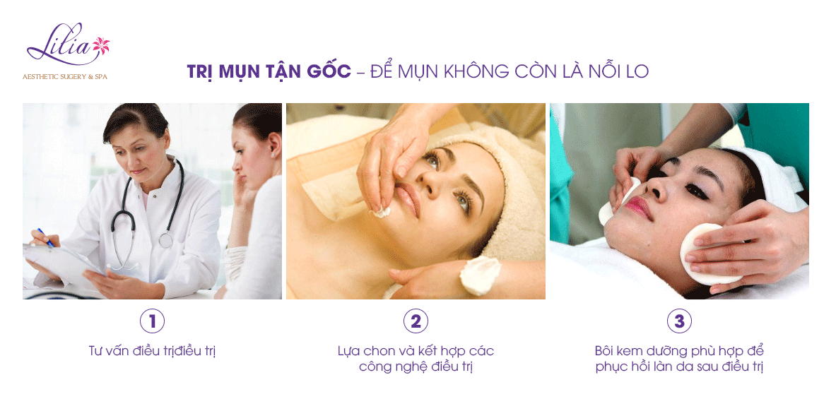 Trị mụn tận gốc